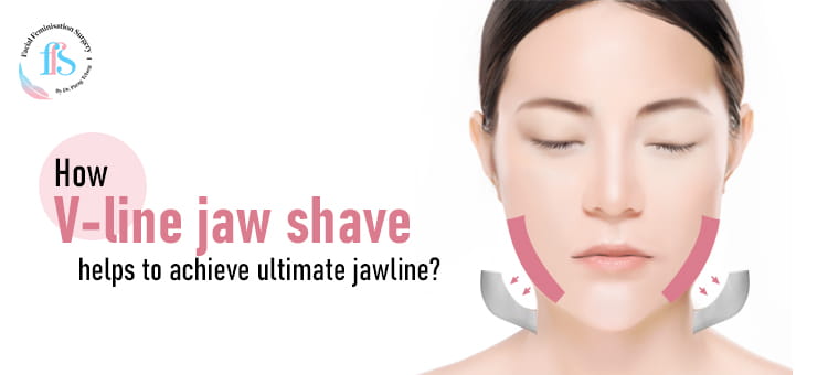 How V-line jaw shave helps to achieve ultimate jawline? 