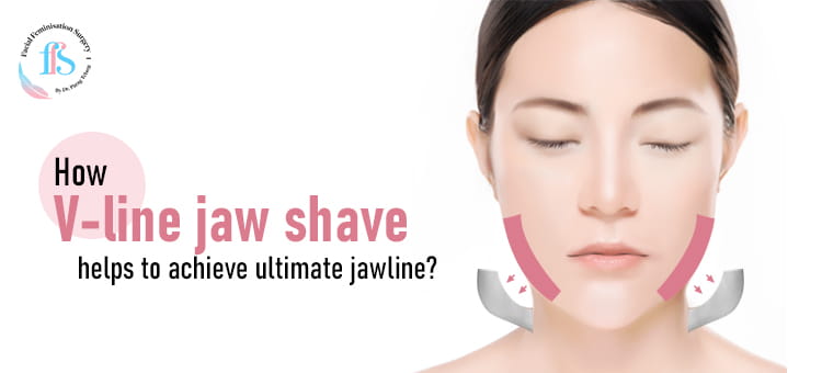 How V-line jaw shave helps to achieve ultimate jawline?