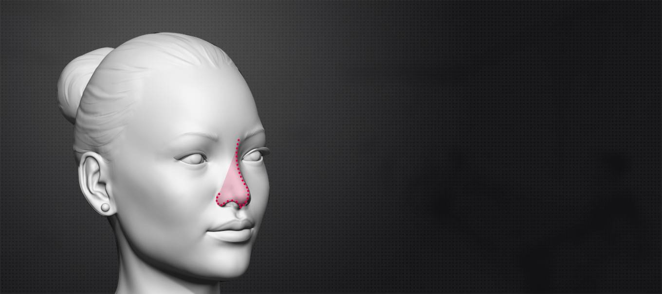 Rhinoplasty Cost in India 